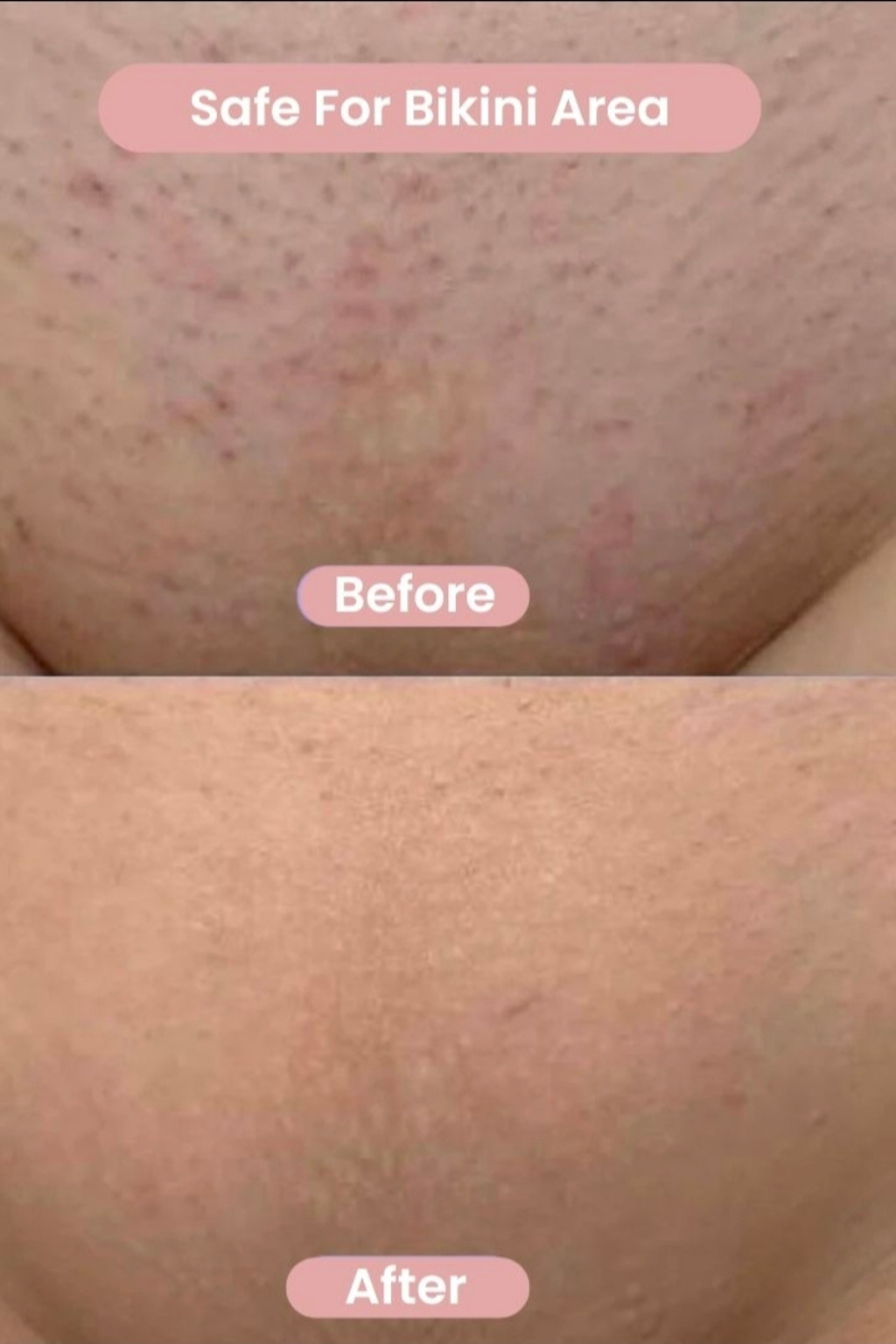 GlowSilk™ Pro | 2-in-1 Women's Electric Shaver - Waterproof