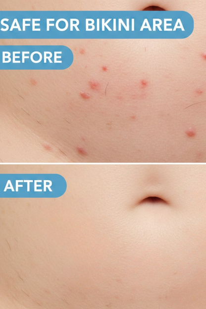 GlowSilk™ Pro | 2-in-1 Women's Electric Shaver - Waterproof